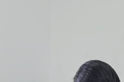 A María se le formó un coágulo en su cabeza, que con el tiempo desapareció.