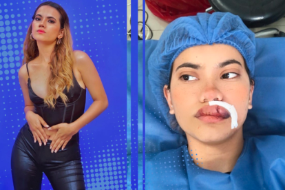 Allison Romero fue cortada con una copa