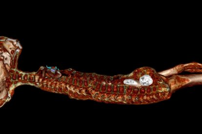 Tres hembras tienen huevos en su vientre.