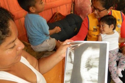 El tratamiento que reciben ahora es solo paliativo para evitar que la enfermedad progrese y que haya complicaciones como fracturas y deformidad anatómica.