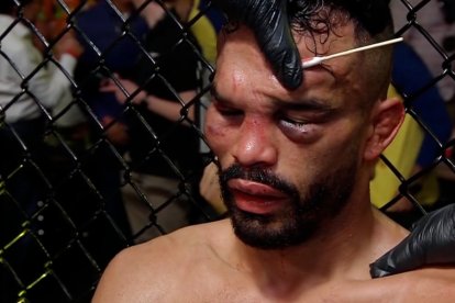 Así terminó el rostro del brasileño tras 25 minutos de castigo.