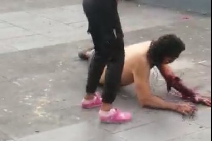 Sin embargo, el extranjero resultó más afectado con un corte en su brazo y una herida en el pecho.