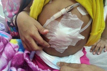 Por su estómago le hacen las diálisis.