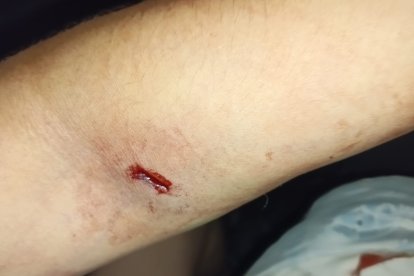 Una moradora fue alcanza por un tiro.