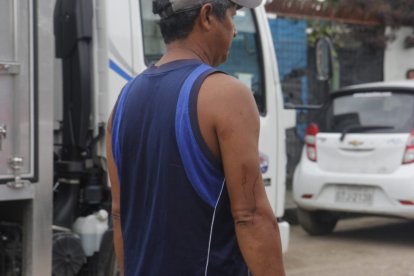 La sangre de uno de los canes quedó en el brazo de uno de los vecinos que ayudó.