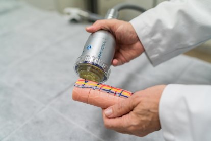 El 57 por ciento de los afectados por la enfermedad de Peyronie, que se somete a un tratamiento con ondas de choque nota mejoras.