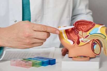 La alta frecuencia de eyaculación está relacionada con un menor riesgo de cáncer de próstata.