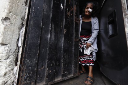 Rosa, con dos puntos en su rostro, muestra las perforaciones que quedaron en la puerta de su vivienda por las balas.