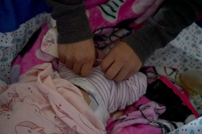 Camila nació sin vesícula y tiene cirrosis hepática, lo que ha puesto en una situación complicada su salud.