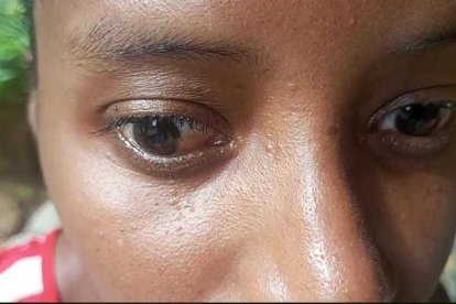 Con la imposibilidad de ver, Diana no puede trabajar, pero confía en  que recibirá ayuda porque tiene  dos niñas a las que debe atender.