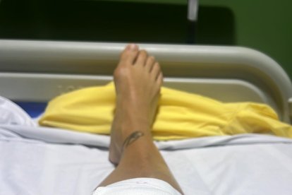 Lesión en la pierna derecha de Paloma Fiuza.