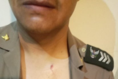 El policía atacado por el presunto violador.