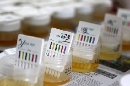 Referencial. Muestras de orina.