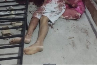 Una de las víctimas que fue socorrida, pero en el camino al hospital dejó de existir.