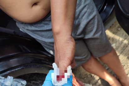 El afectado perdió un dedo a manos de los criminales.