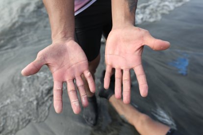 Las ampollas de uno de los remeros de Manuel Calle.