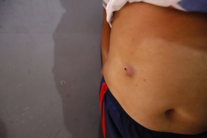 La bala atravesó la puerta y rozó el abdomen del abuelo.