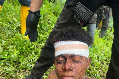 Los heridos fueron llevados a un subcentro de la zona.