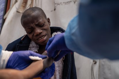 Hombre infectado con viruela del simio es atendido por personal de salud en el Congo.