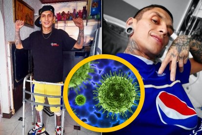 Candida auris es la bacteria que afectó a Javier Acosta.