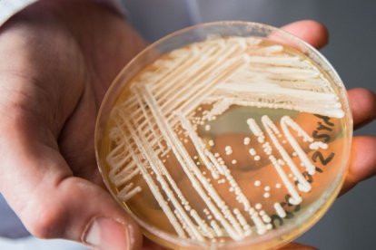 Científico sostiene una placa de Petri que contiene Candida auris.