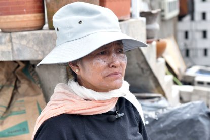 María Chango también tuvo quemaduras en su rostro.
