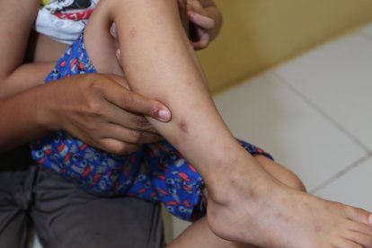 Edith muestra que los suplementos básicos que necesitan son variados.