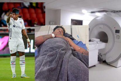 Richard Mina recibirá una resonancia magnética el 5 de diciembre del 2025.