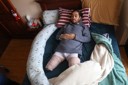 Diego Herrera sufrió la amputación de ambas piernas