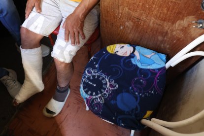 Luis se recupera en su casa.