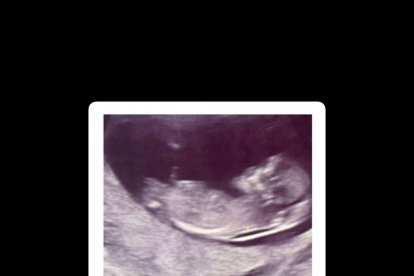 El eco del bebé que nacerá en septiembre de este año.