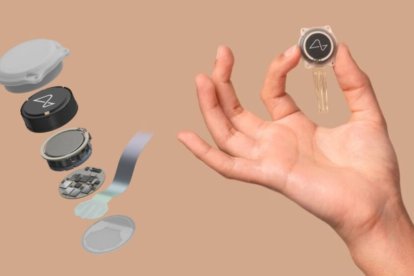 El chip cerebral de Neuralink ya fue implantado en un paciente humano, con resultados iniciales positivos.