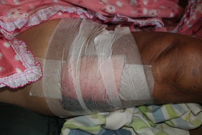 Una víctima colateral quedó herida.