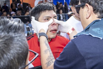 Durante las peleas, siempre alguno de los combatientes termina con fracturas.