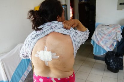 Carolina sufre de fuertes dolores de columna, debido al cáncer.