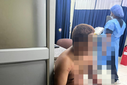 José tras ser herido por presuntos criminales.