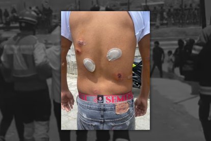 Las fuerzas del orden habrían utilizado balas de goma.