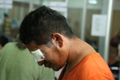El lesionado estaba en custodia, esposado, cuando fue golpeado.