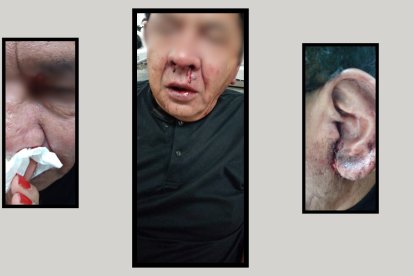 Una de las heridas más graves la sufrió en una oreja.