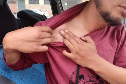 Rodrigo muestra una de las heridas que al parecer le causaron quienes les robaron.