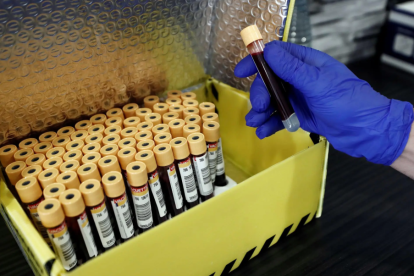 Un análisis de sangre permite diagnosticar la enfermedad del Alzheimer con una precisión de alrededor del 95 %