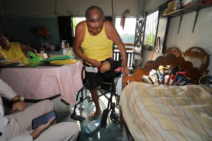 Don Klever muestra las cicatrices que le dejaron sus amputaciones.