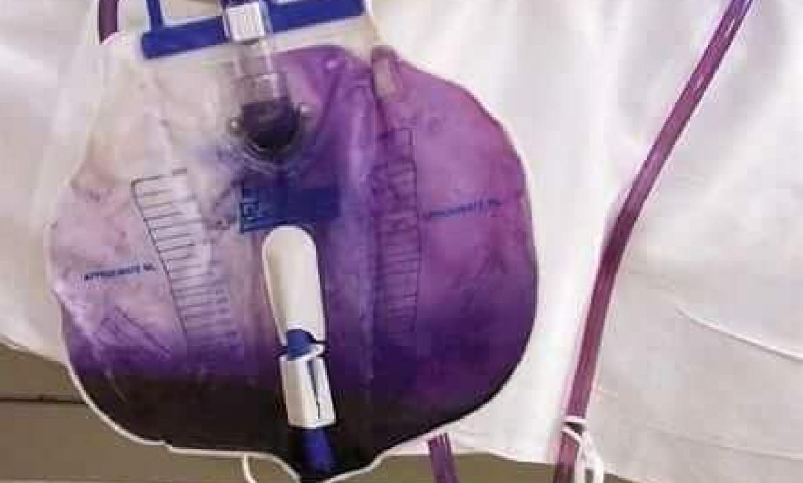 Imagen orine morado
