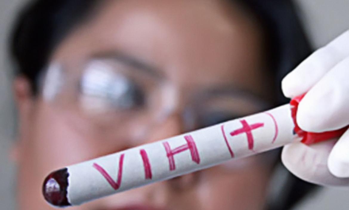EL VIH O SIDA SE HA VUELTO UNA EPIDEMIA OLVIDADA
