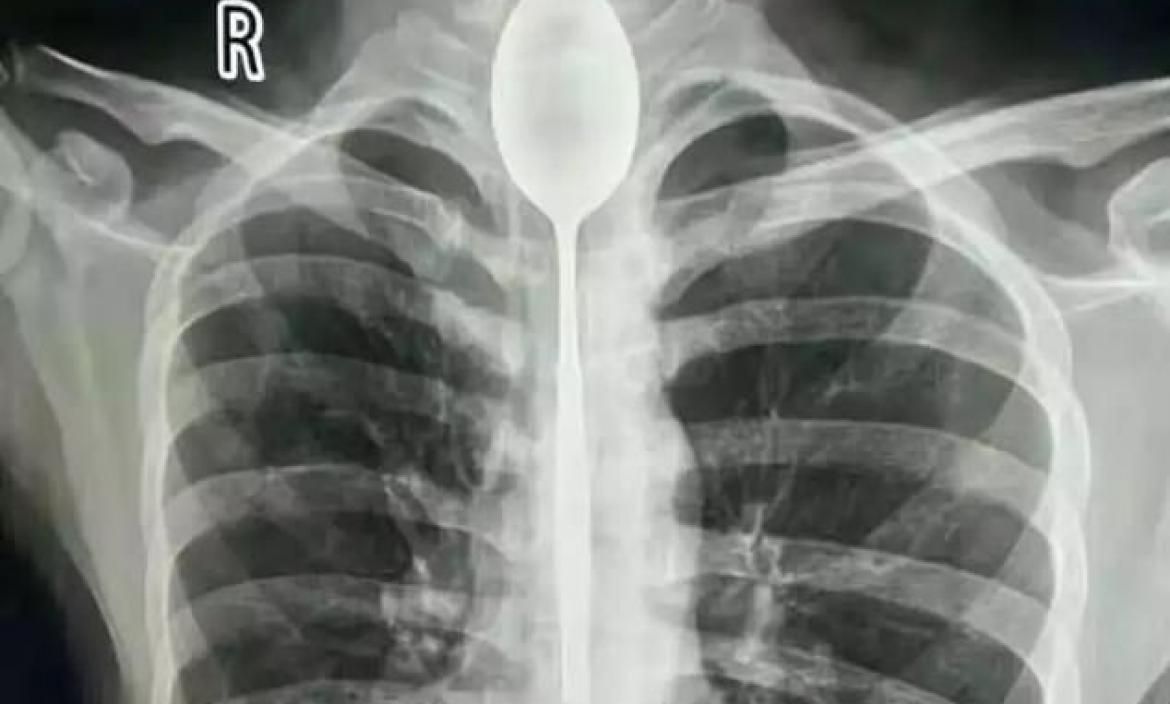 Imagen 5398734-6315717-An_x_ray_image_showi (26160651)