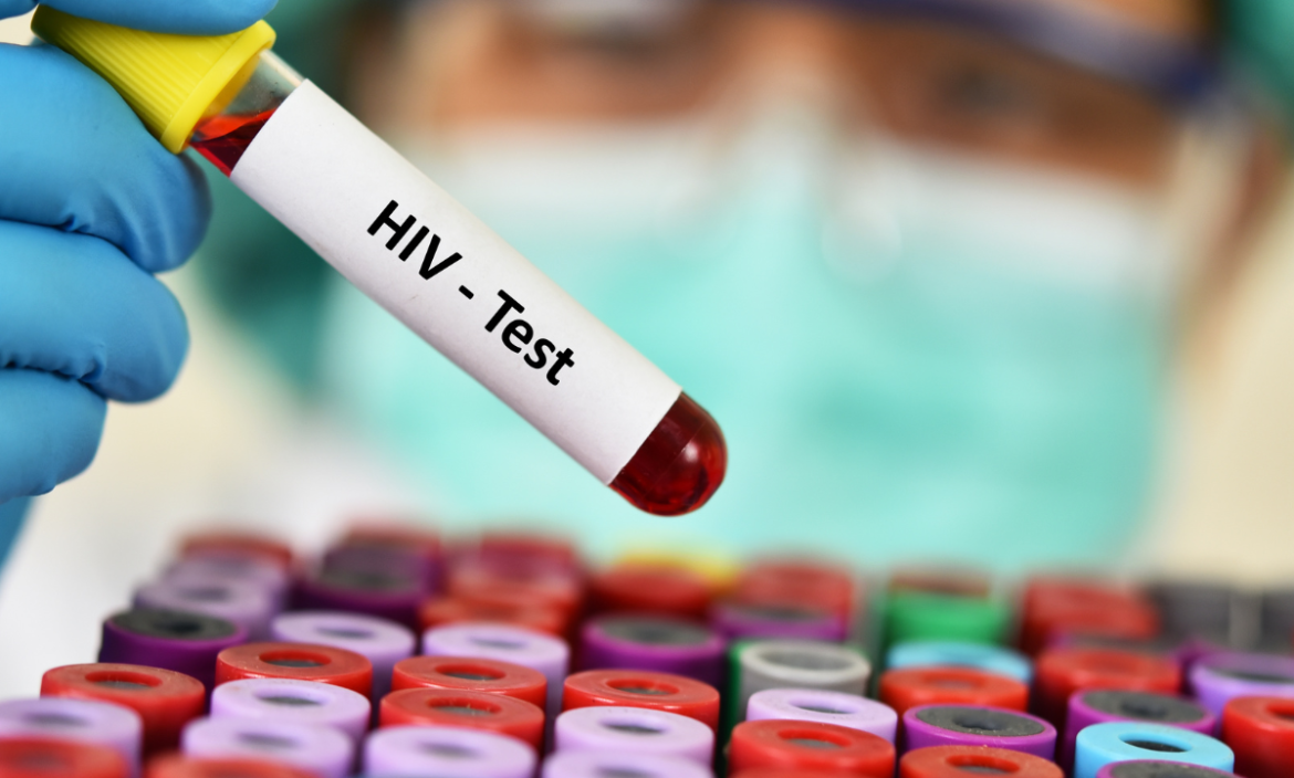 Un compuesto en el semen inhibe una variante del VIH