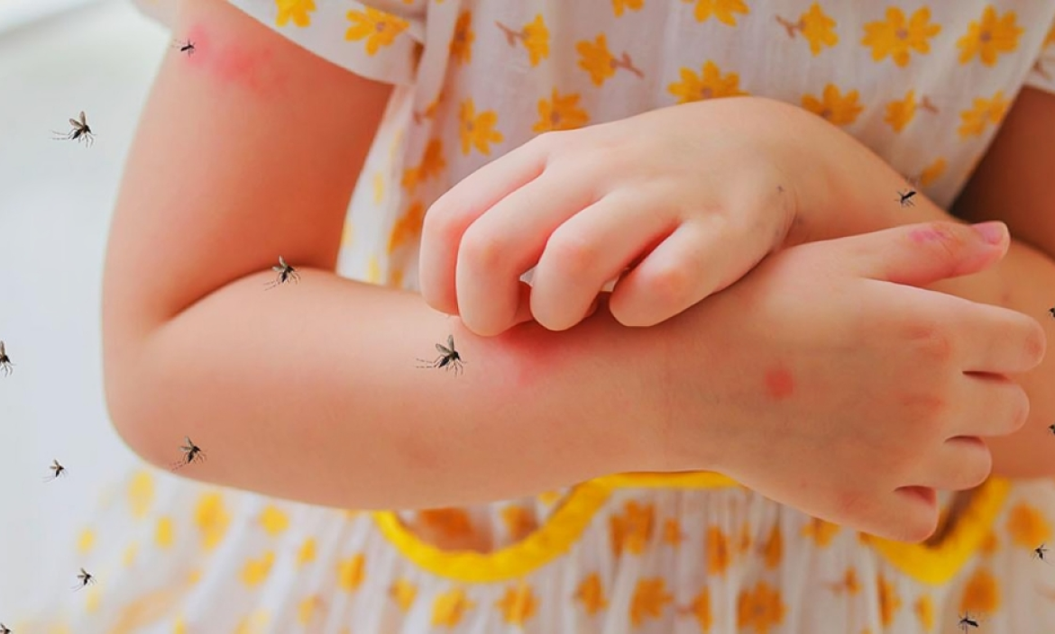 Los niños corren mayor riesgo de contraer dengue grave.