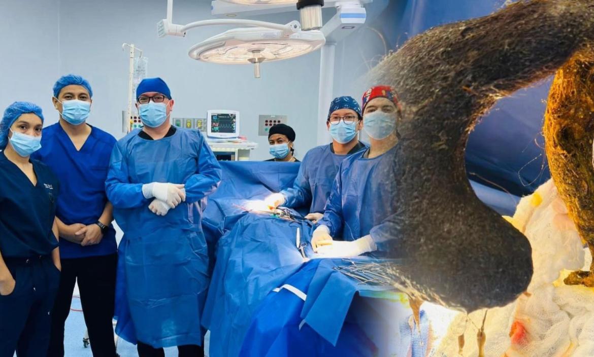 Equipo de médicos que extrajo el cuerpo extraño de la mujer en el hospital Verdi Cevallos Balda.