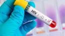 Revelan una nueva vulnerabilidad del VIH que podría ser objeto de fármacos