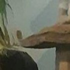 La cantante adolece de un extraño síndrome que le está trayendo complicaciones.